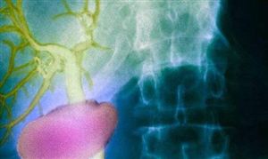 科學家在人體內(nèi)發(fā)現(xiàn)未知新器官 2020年智能醫(yī)療行業(yè)投資趨勢分析調(diào)研