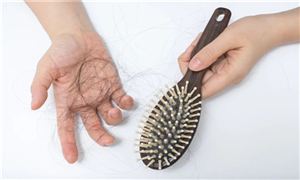 年輕人脫發(fā)的4個(gè)主要原因，防脫生發(fā)洗發(fā)水哪個(gè)牌子好 防脫生發(fā)洗發(fā)水推薦