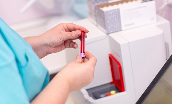 血氣分析儀行業(yè)分析：血氣分析儀逐漸朝著便攜式、免維護、易操作等方向發(fā)展